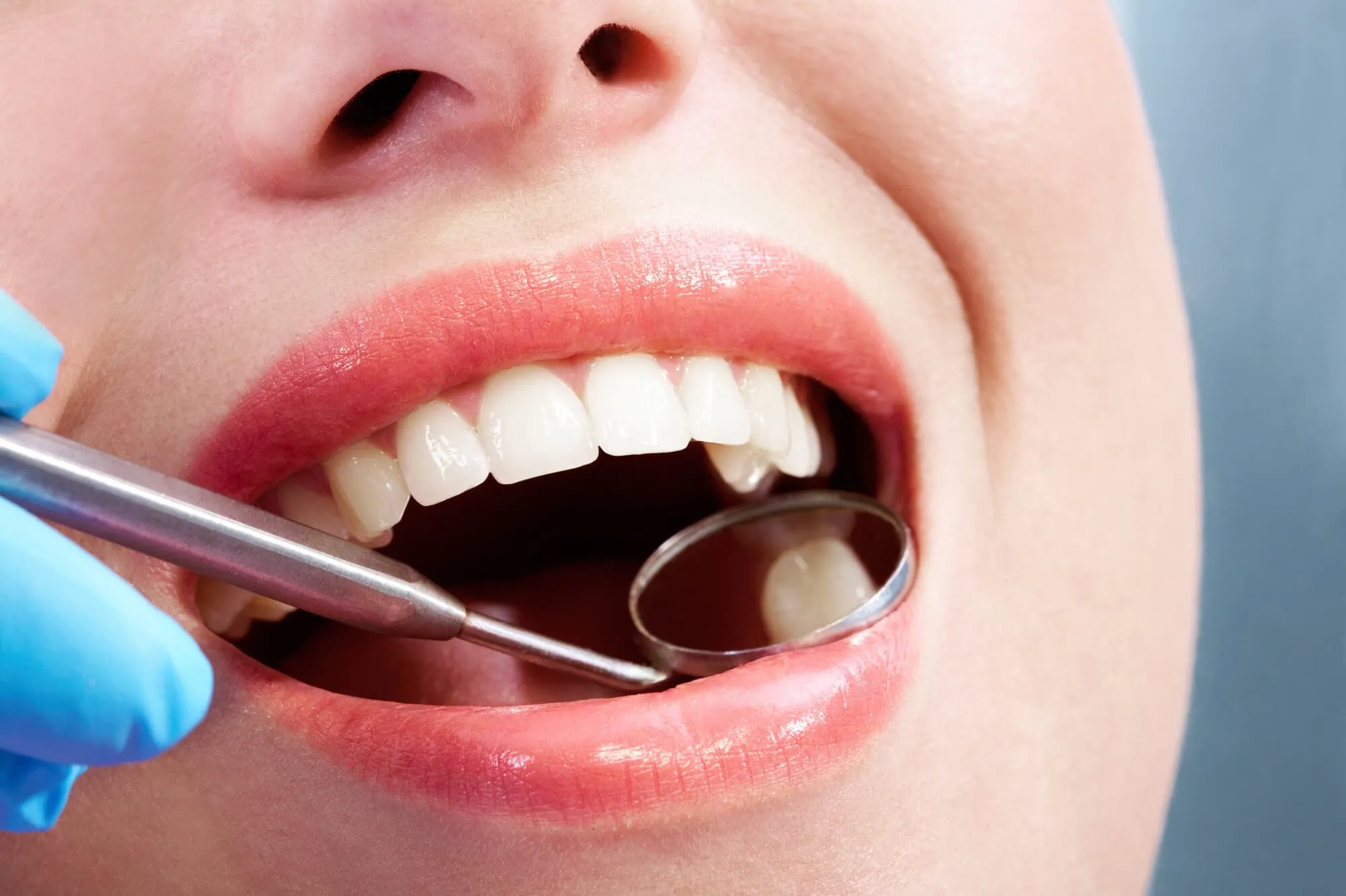 especialista en periodoncia cdmx