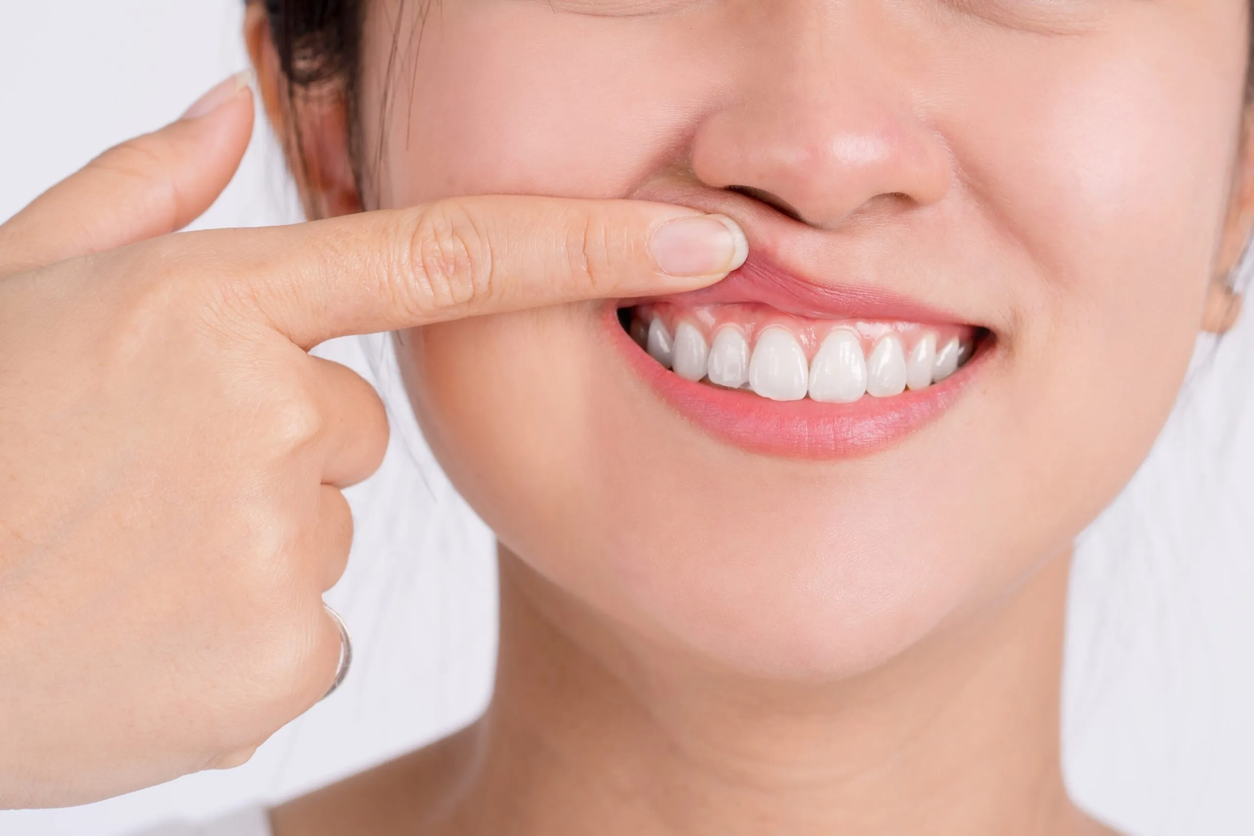 periodoncista en cdmx 